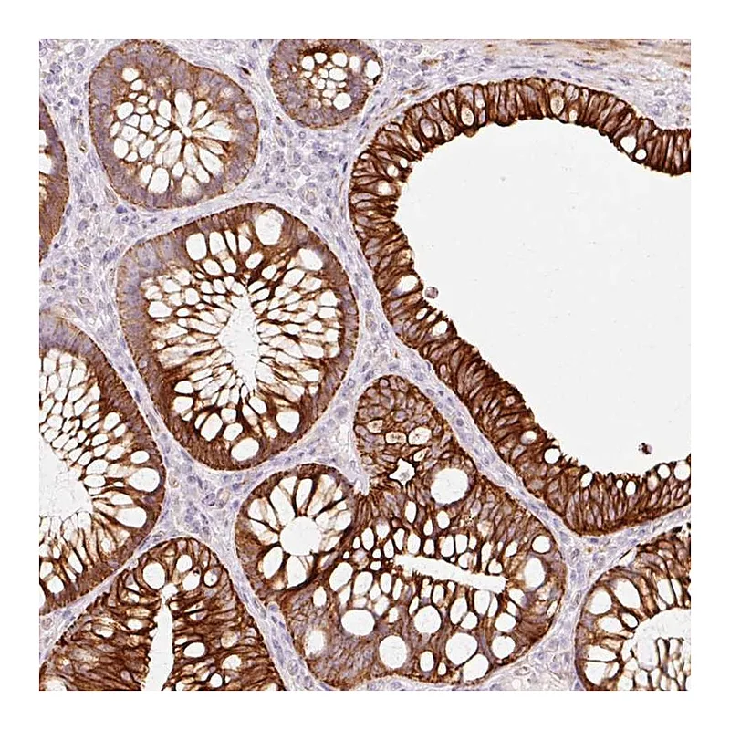 Atlas Antibodies Anti-TRIM73 Antibody