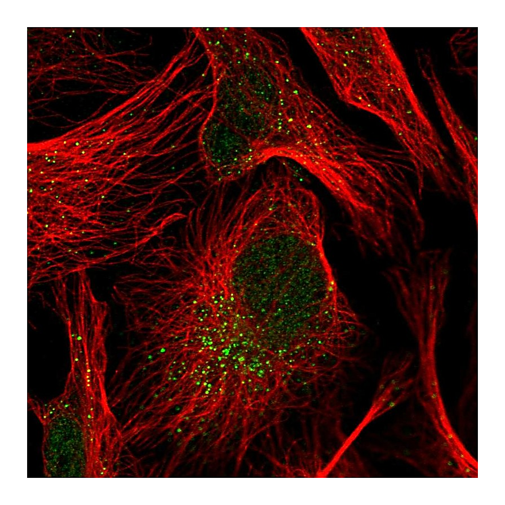 Atlas Antibodies Anti-TRIP10 Antibody