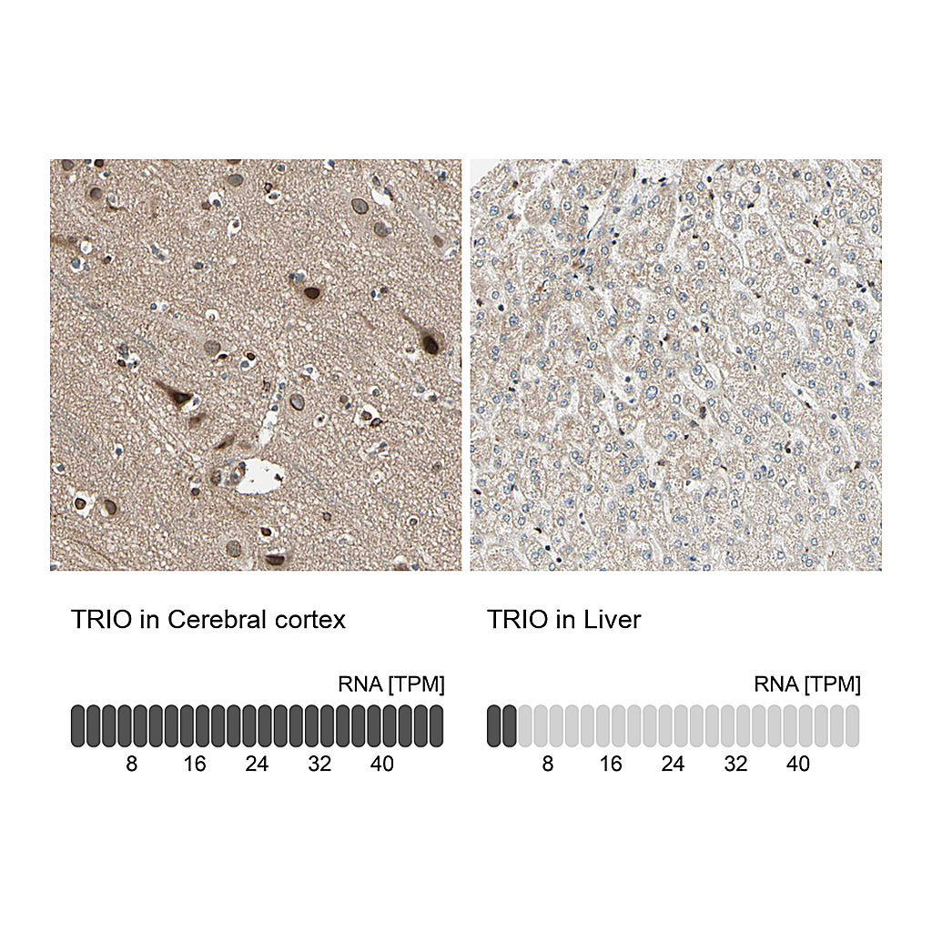 Atlas Antibodies Anti-TRIO Antibody