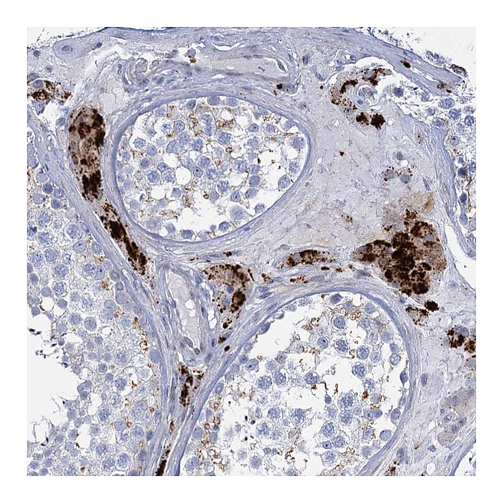 Atlas Antibodies Anti-TRIM77 Antibody