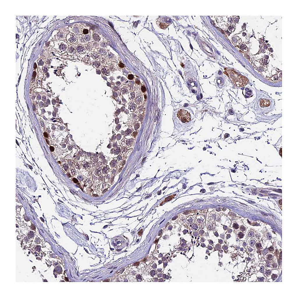 Atlas Antibodies Anti-TRIML2 Antibody