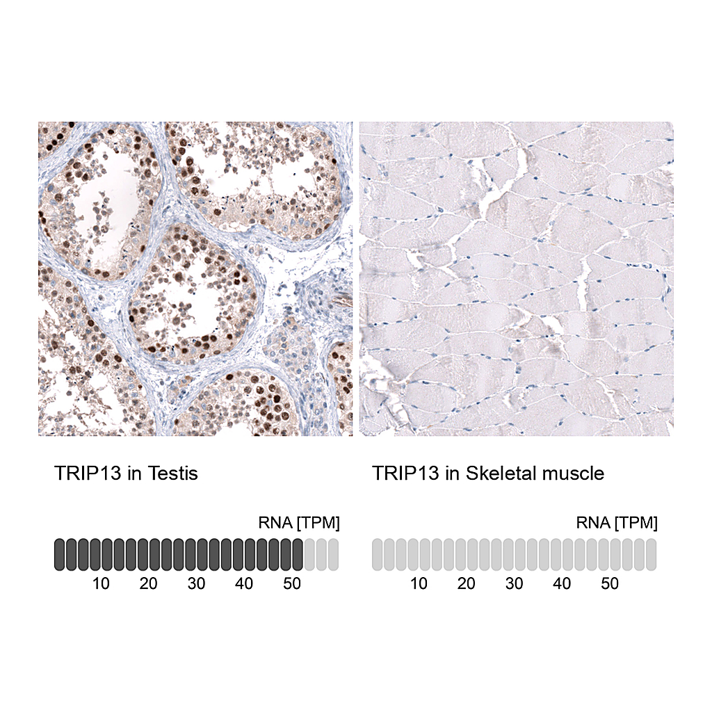Atlas Antibodies Anti-TRIP13 Antibody