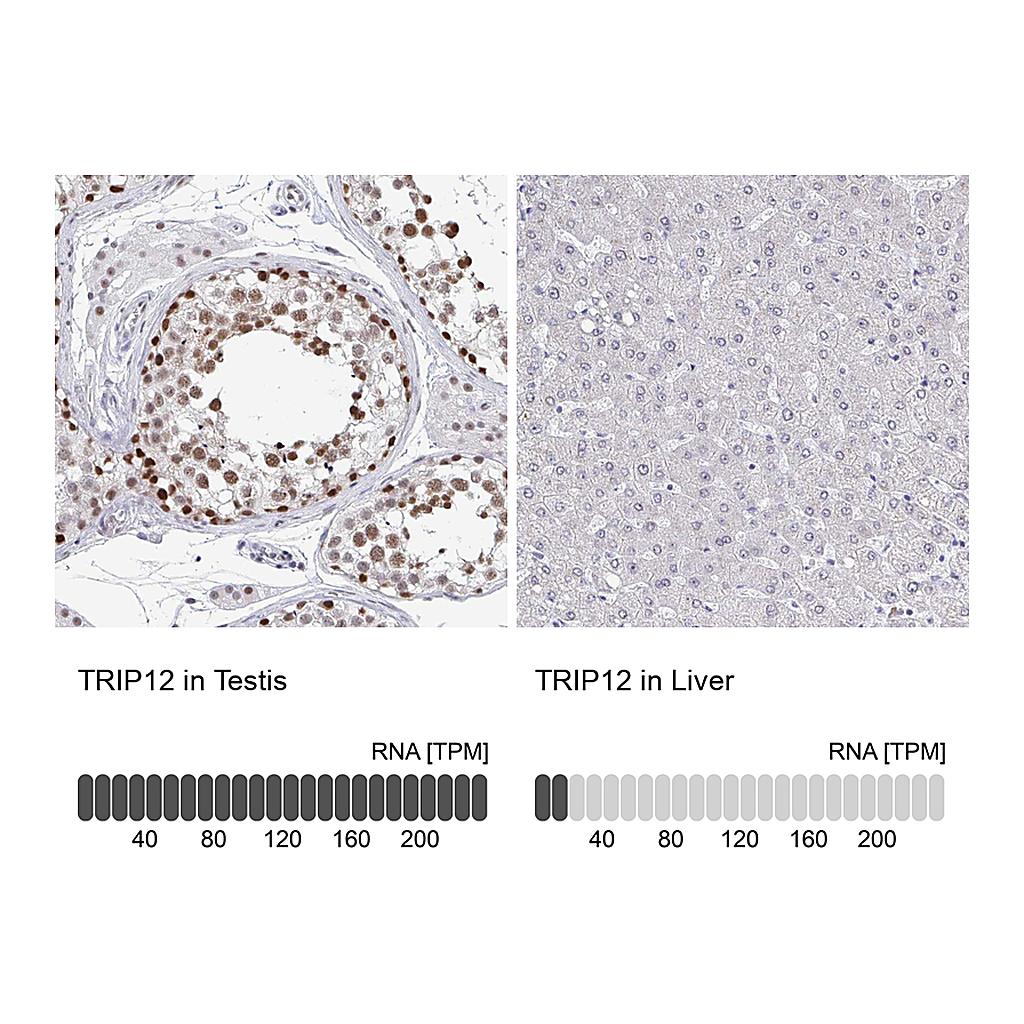 Atlas Antibodies Anti-TRIP12 Antibody