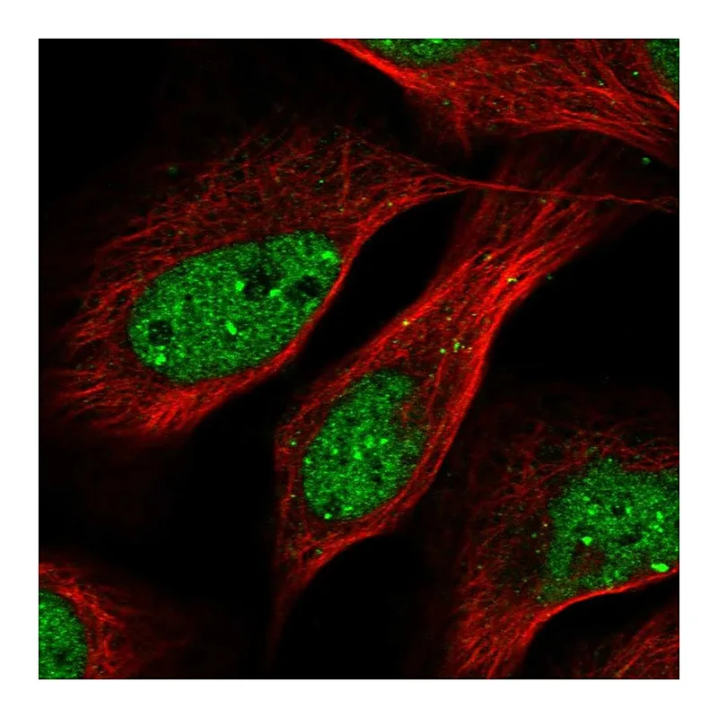 Atlas Antibodies Anti-TRIP4 Antibody