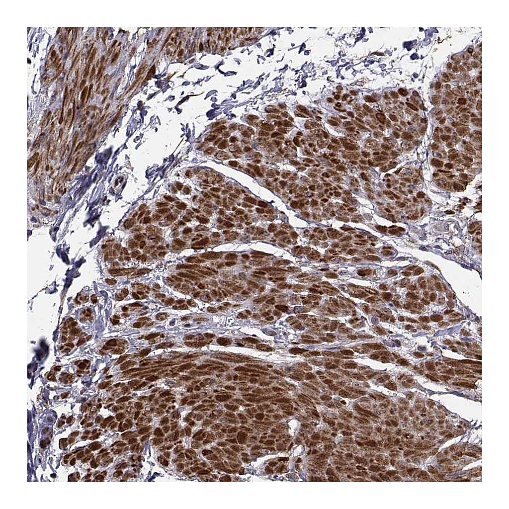 Atlas Antibodies Anti-TRIP10 Antibody