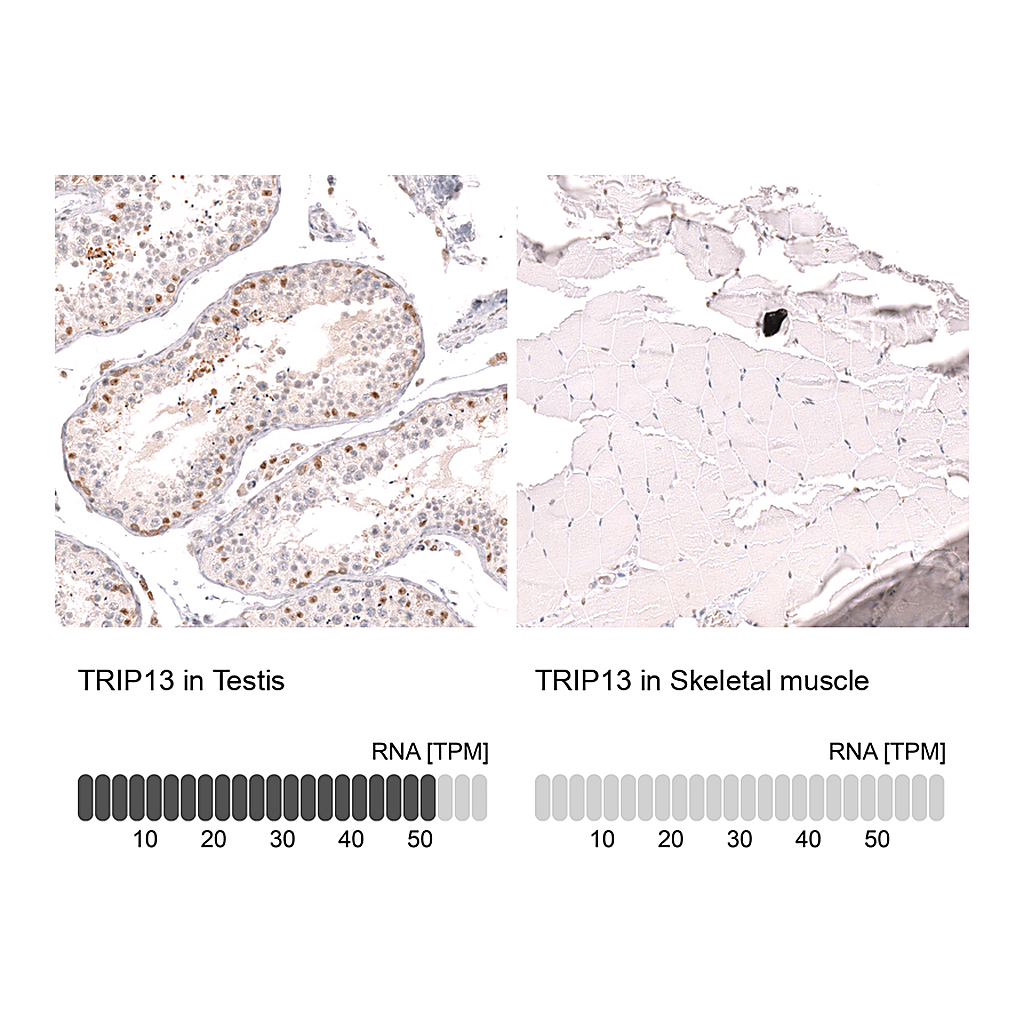 Atlas Antibodies Anti-TRIP13 Antibody