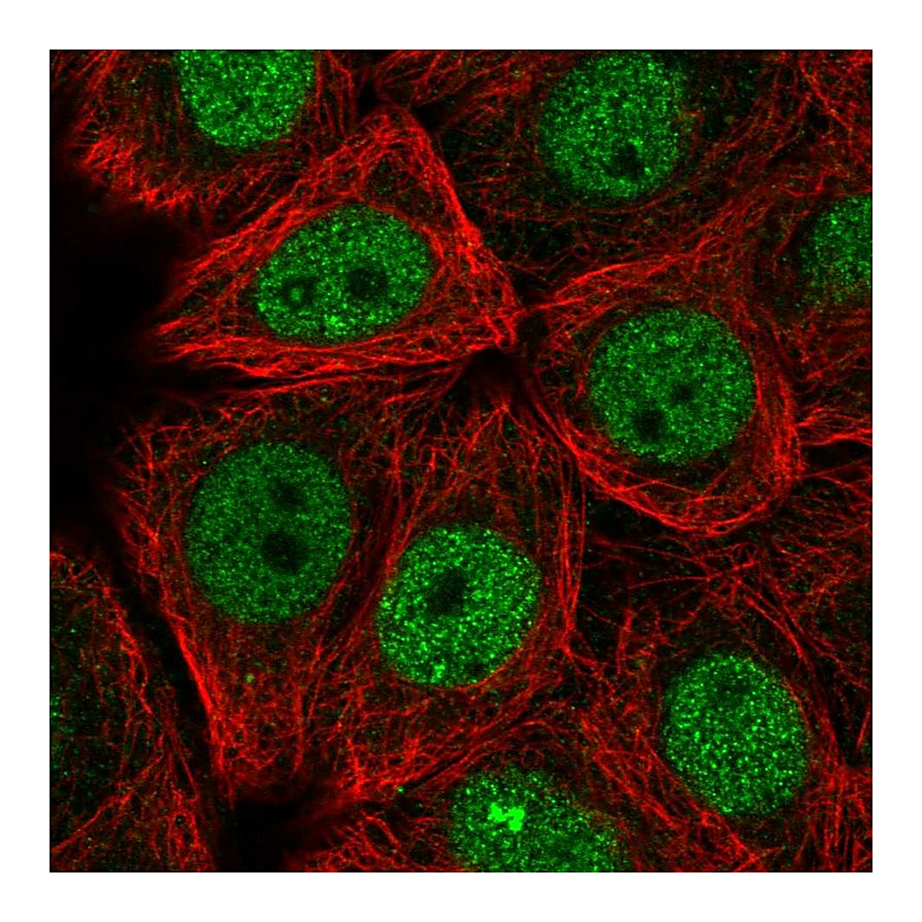 Atlas Antibodies Anti-TRMO Antibody