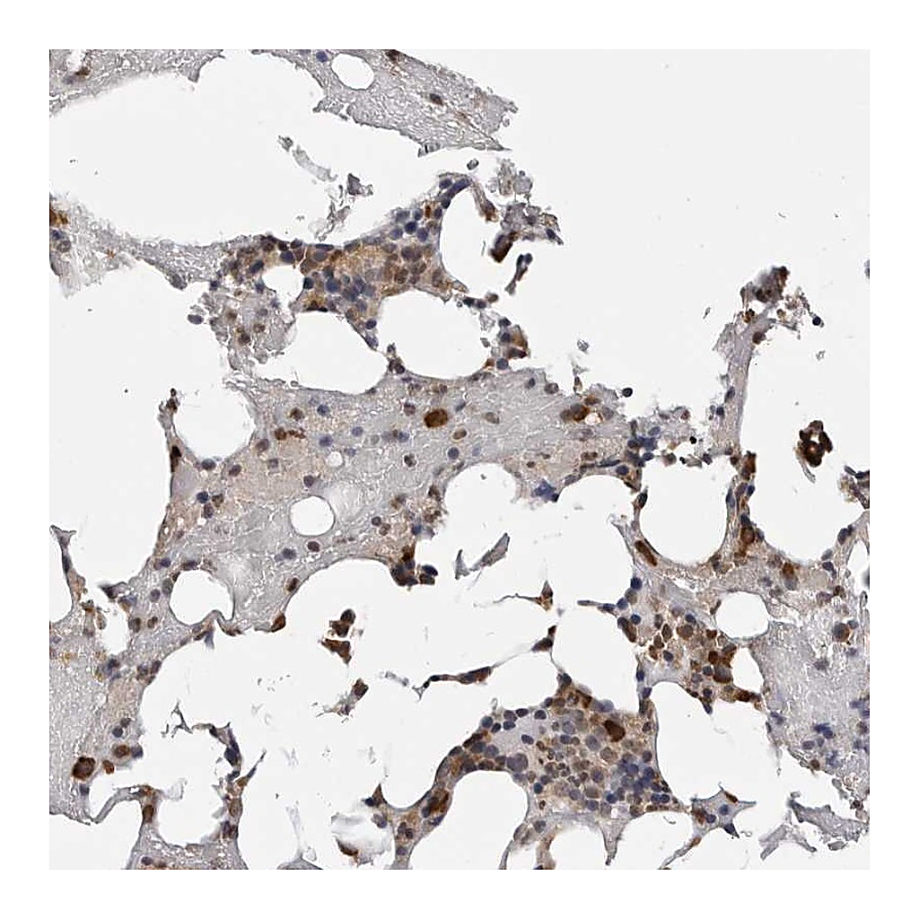 Atlas Antibodies Anti-TRMT13 Antibody