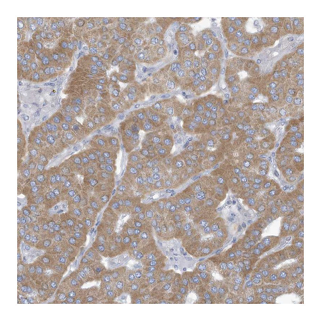 Atlas Antibodies Anti-TRMT2B Antibody