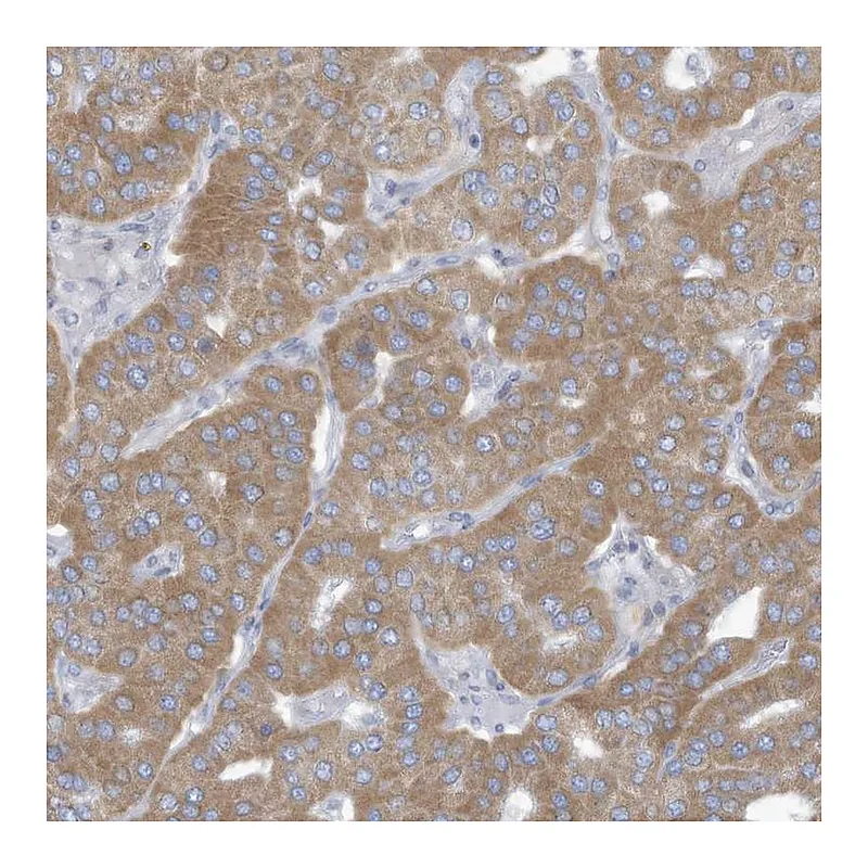 Atlas Antibodies Anti-TRMT2B Antibody