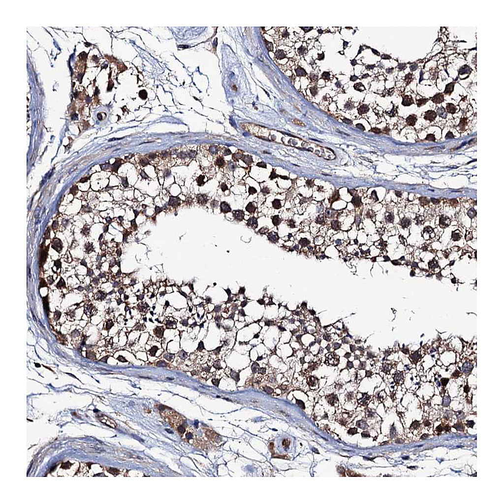Atlas Antibodies Anti-TRMT112 Antibody
