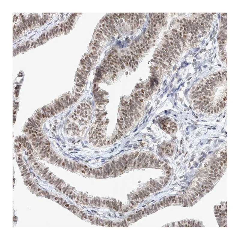 Atlas Antibodies Anti-TRMT12 Antibody