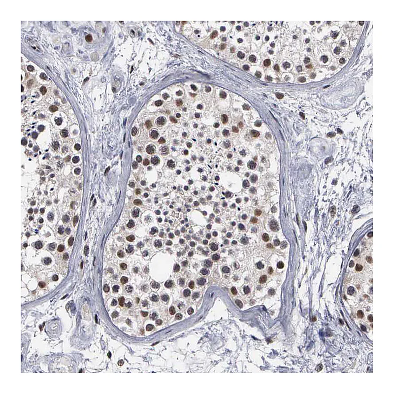 Atlas Antibodies Anti-TRMT5 Antibody