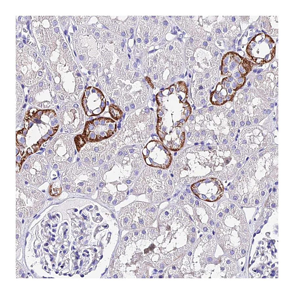 Atlas Antibodies Anti-TRMT44 Antibody