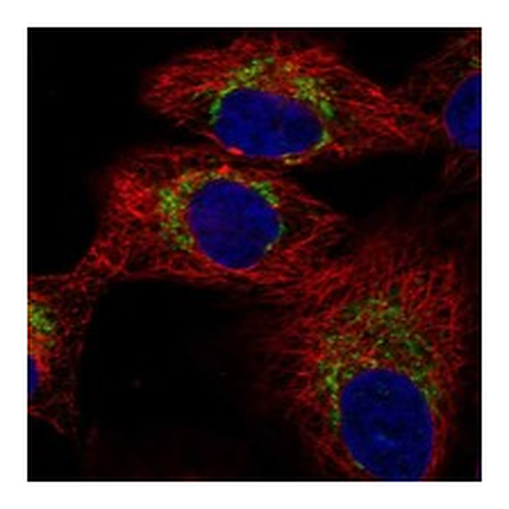 Atlas Antibodies Anti-TRMT61A Antibody