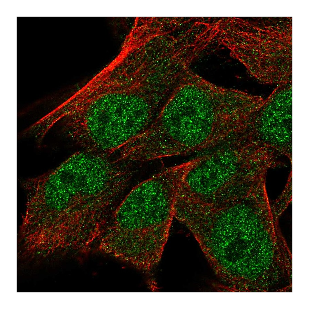 Atlas Antibodies Anti-TRNAU1AP Antibody