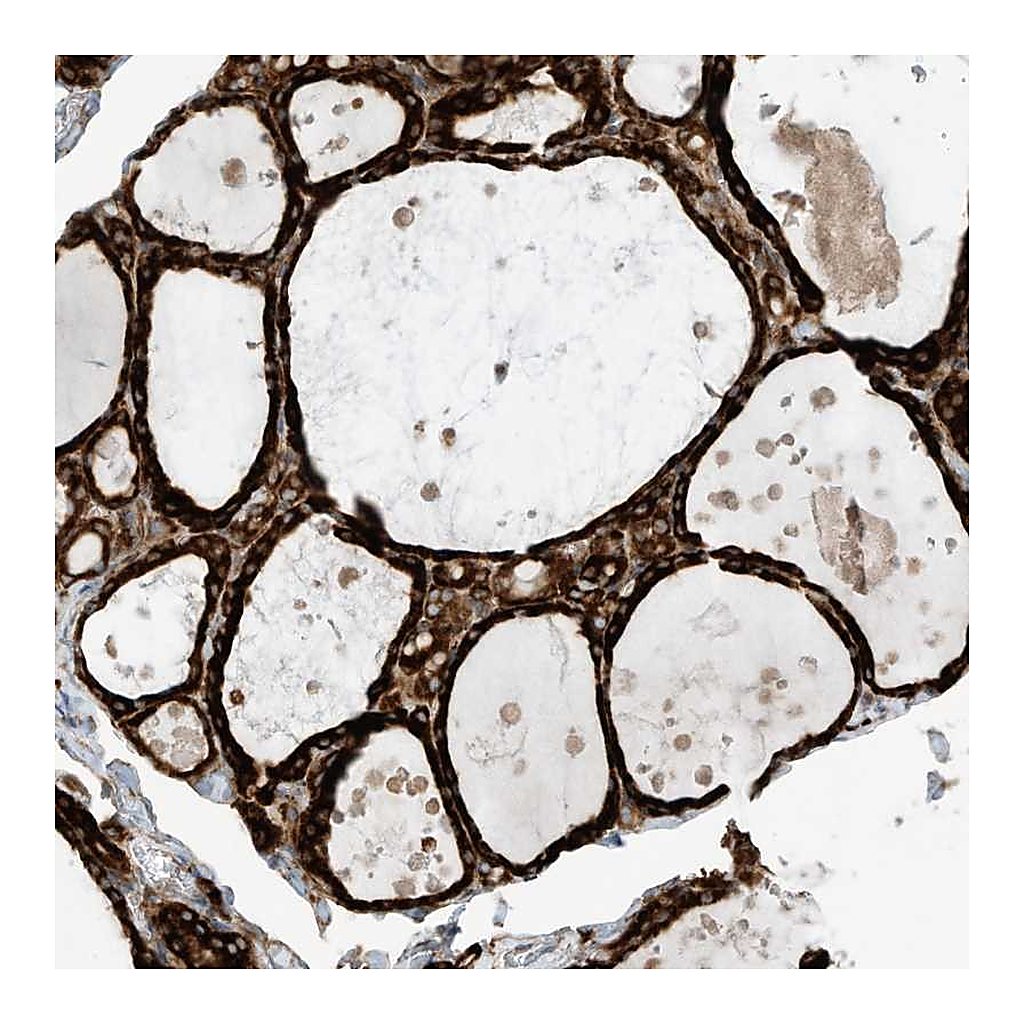 Atlas Antibodies Anti-TRNAU1AP Antibody