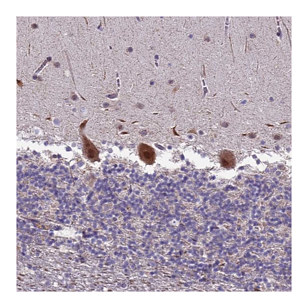 Atlas Antibodies Anti-TROAP Antibody