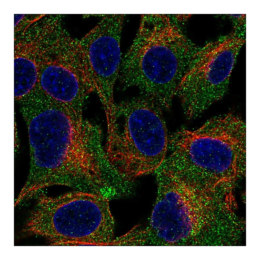 Atlas Antibodies Anti-TRPC4AP Antibody