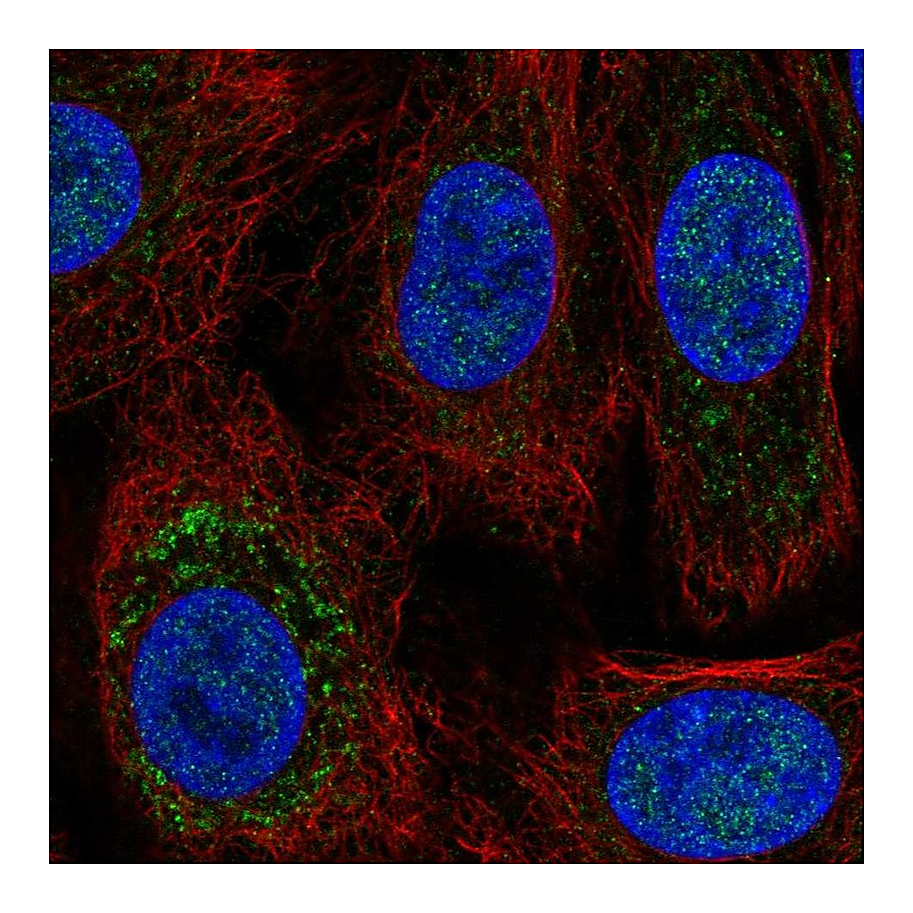 Atlas Antibodies Anti-TRPC6 Antibody