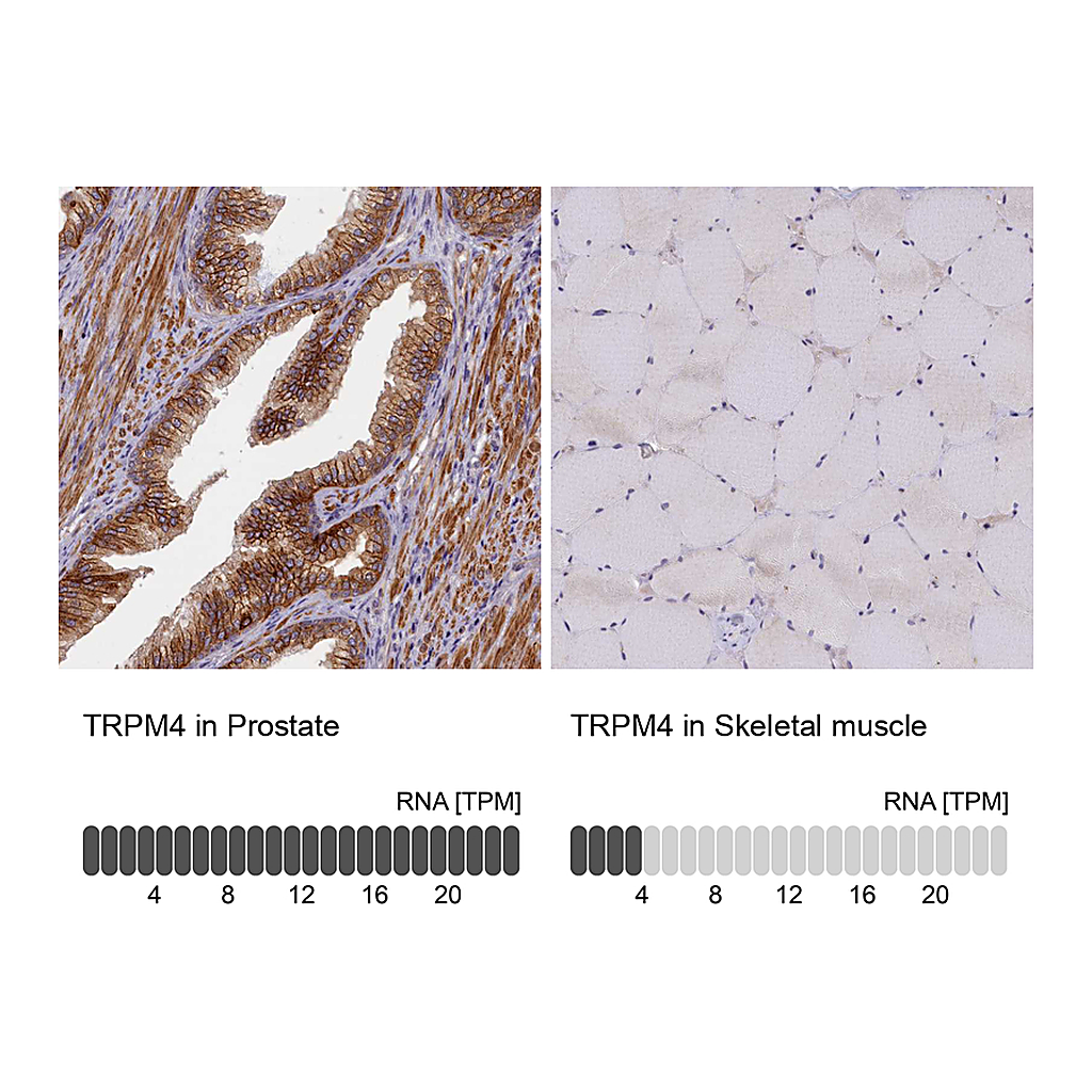 Atlas Antibodies Anti-TRPM4 Antibody