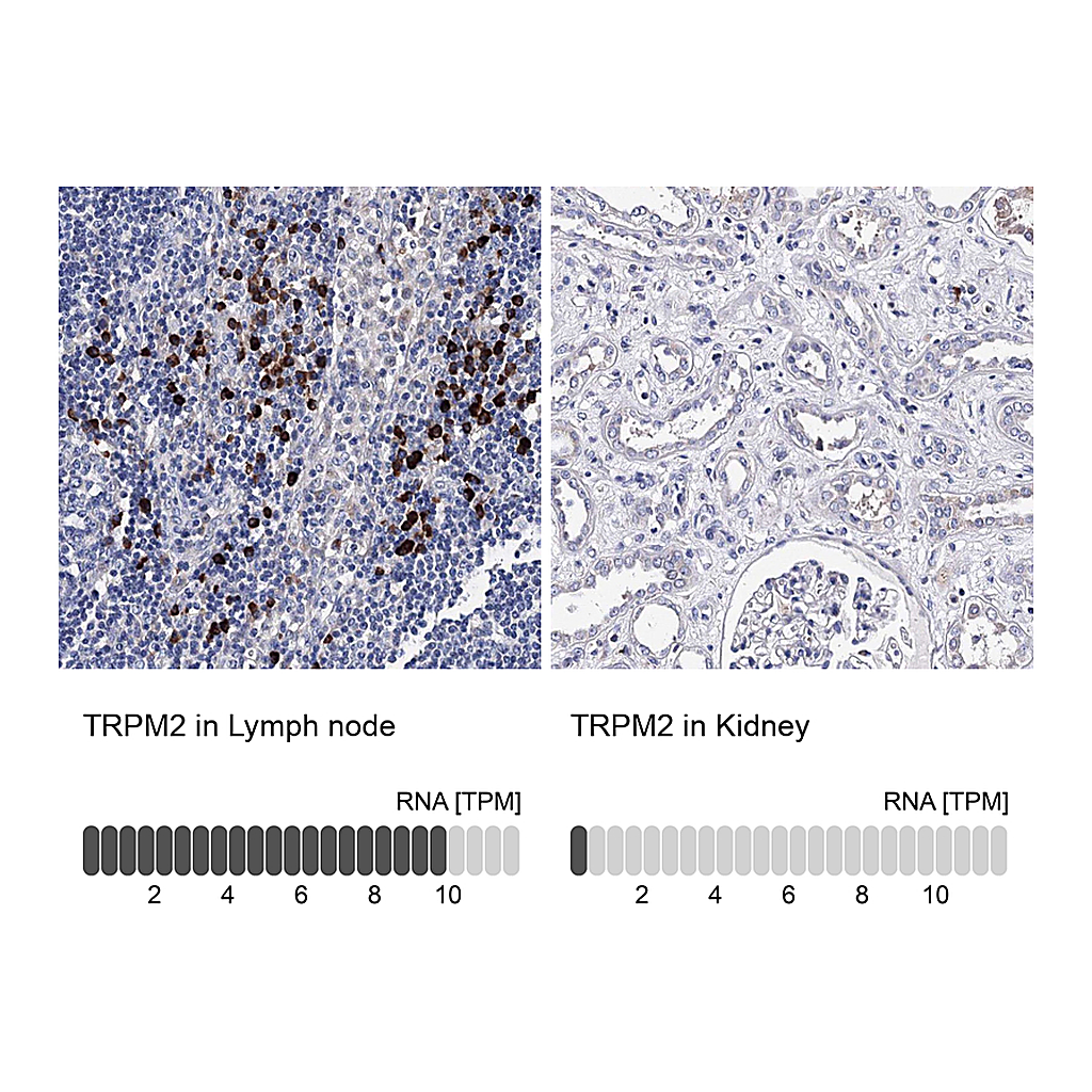Atlas Antibodies Anti-TRPM2 Antibody