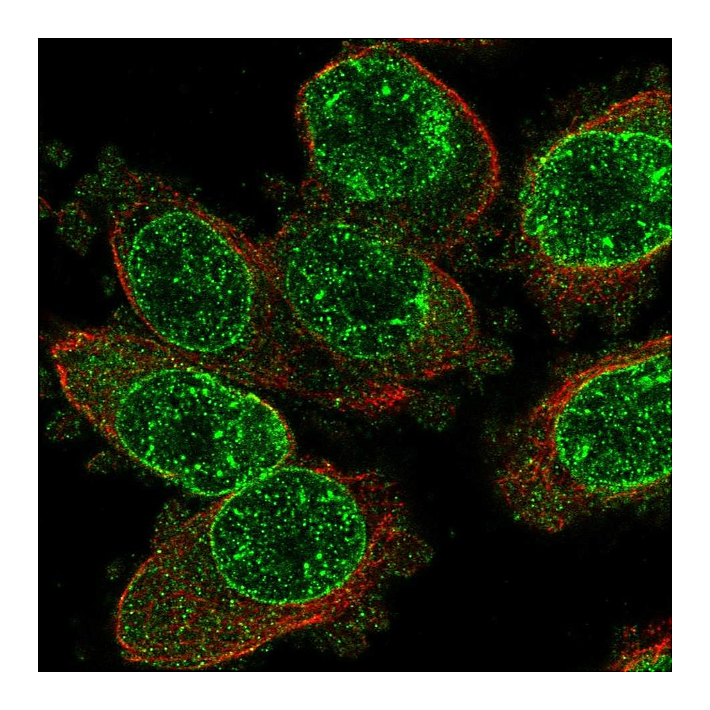 Atlas Antibodies Anti-TRPM2 Antibody