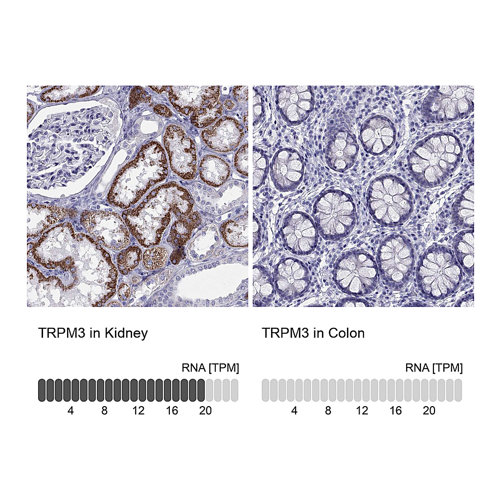 Atlas Antibodies Anti-TRPM3 Antibody