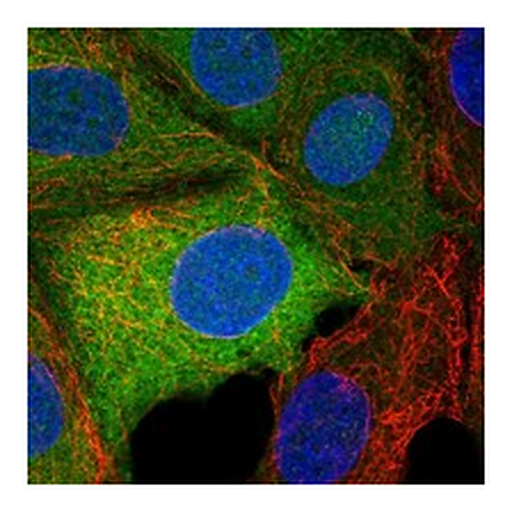 Atlas Antibodies Anti-TRPM7 Antibody