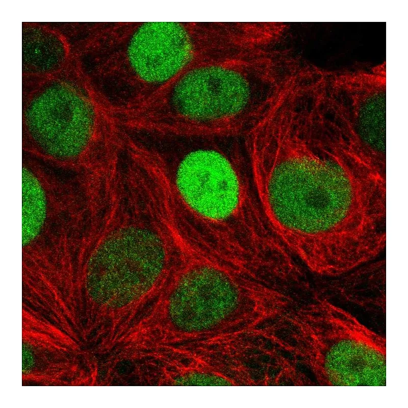 Atlas Antibodies Anti-TRPS1 Antibody