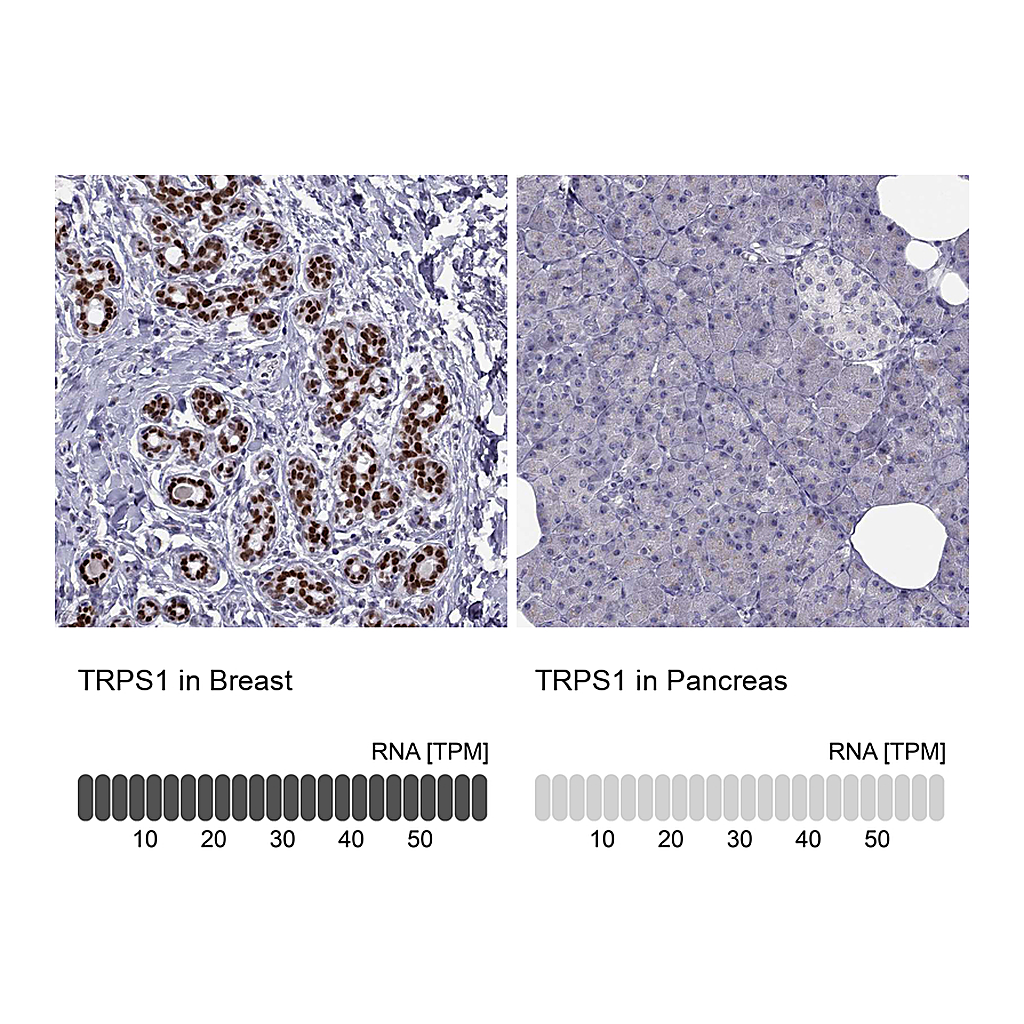 Atlas Antibodies Anti-TRPS1 Antibody