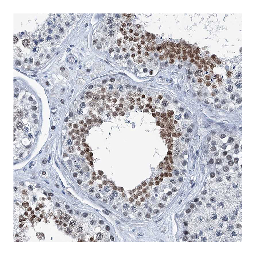 Atlas Antibodies Anti-TRPT1 Antibody