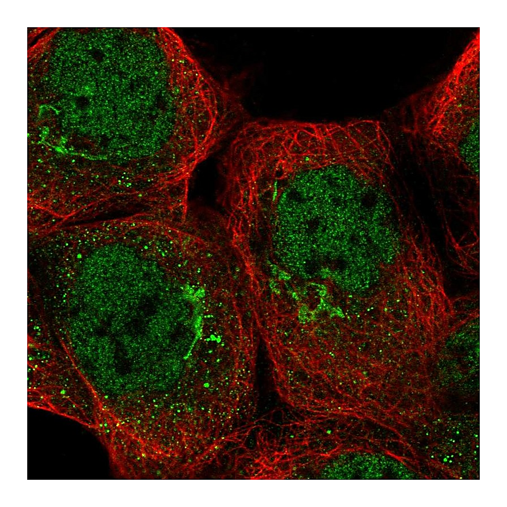 Atlas Antibodies Anti-TRRAP Antibody