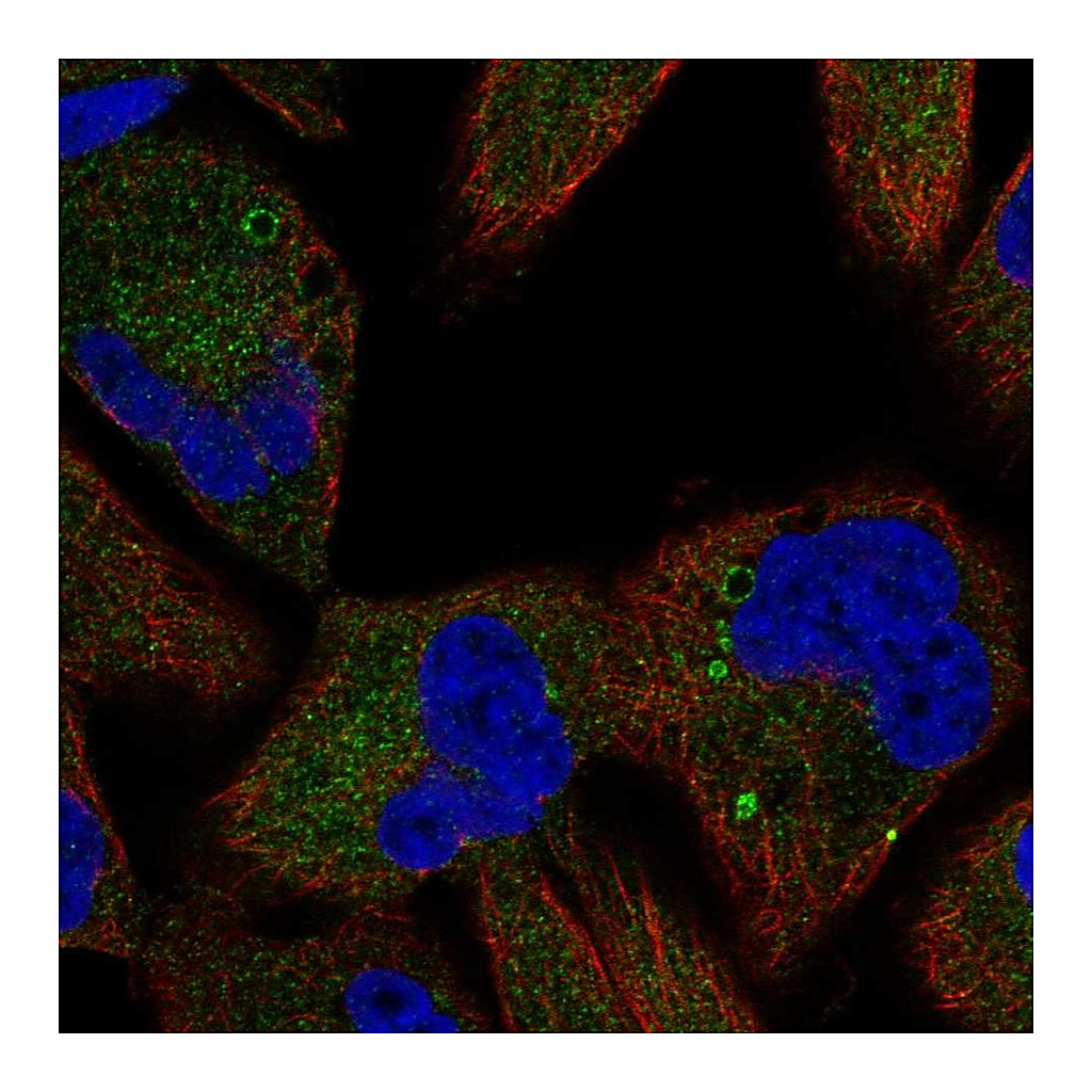 Atlas Antibodies Anti-TSC1 Antibody