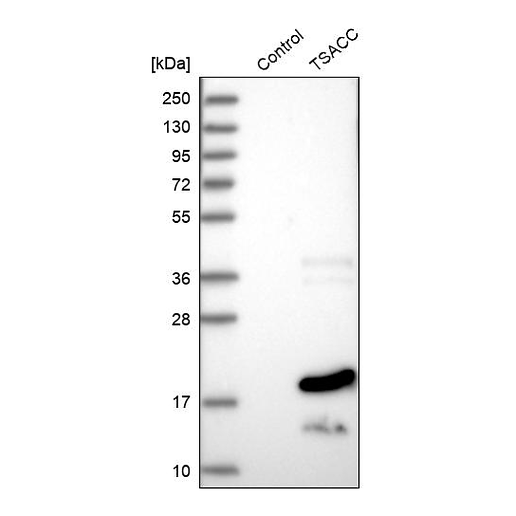 Atlas Antibodies Anti-TSACC Antibody