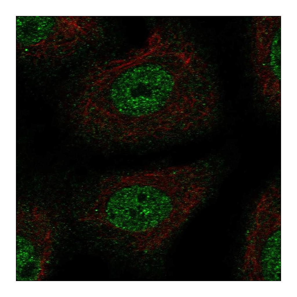 Atlas Antibodies Anti-TSC22D1 Antibody