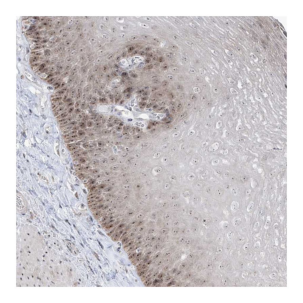Atlas Antibodies Anti-TSEN15 Antibody