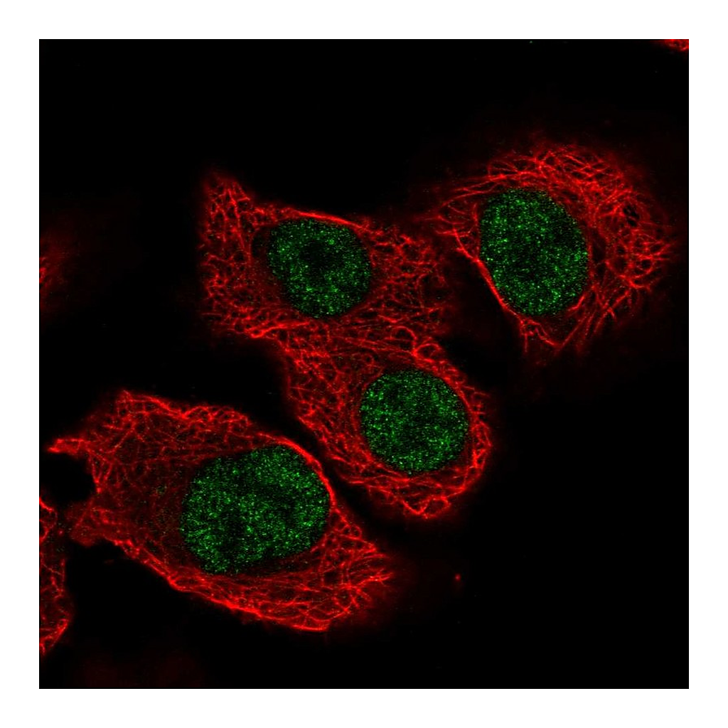 Atlas Antibodies Anti-TSEN34 Antibody