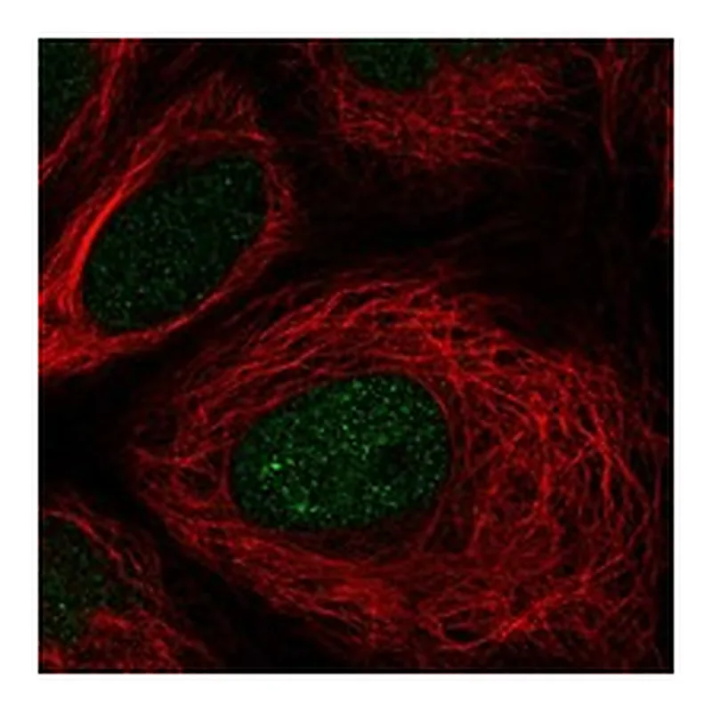 Atlas Antibodies Anti-TSEN54 Antibody