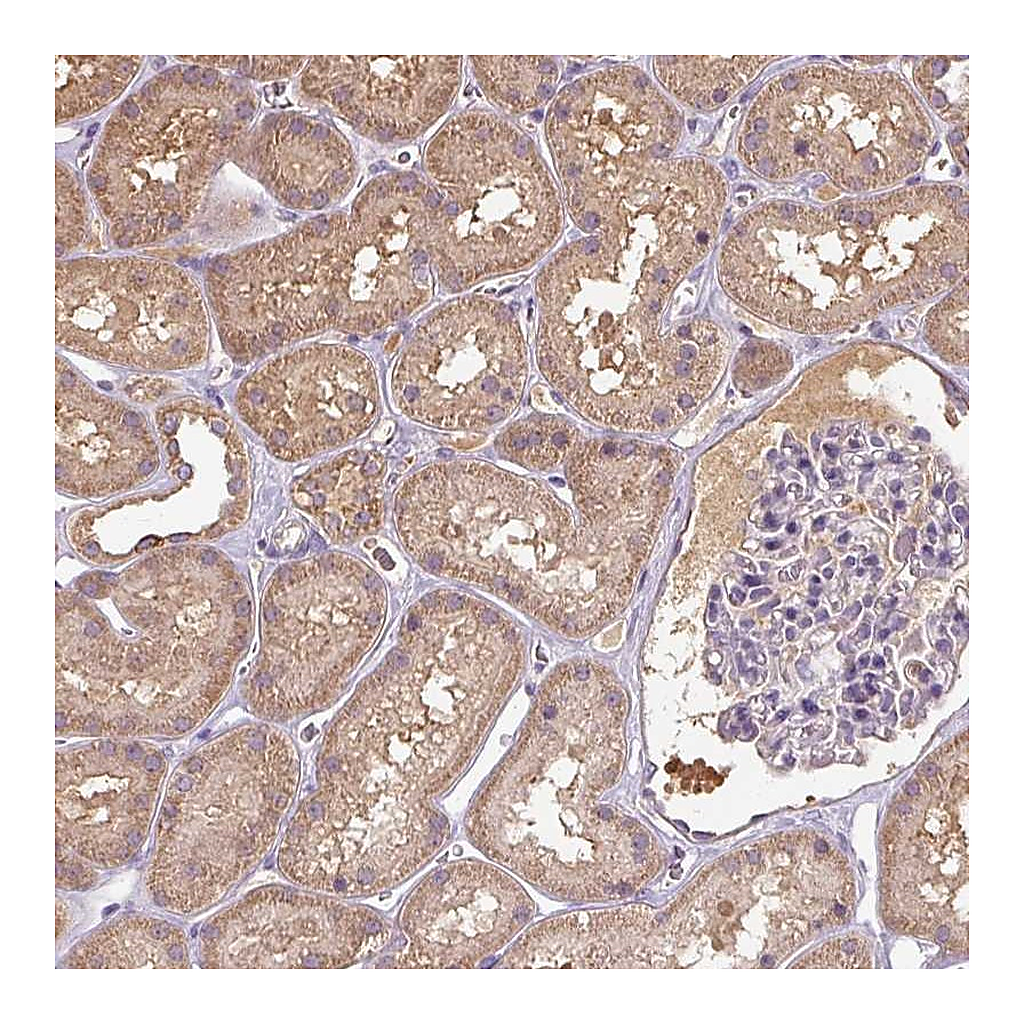 Atlas Antibodies Anti-TSEN54 Antibody
