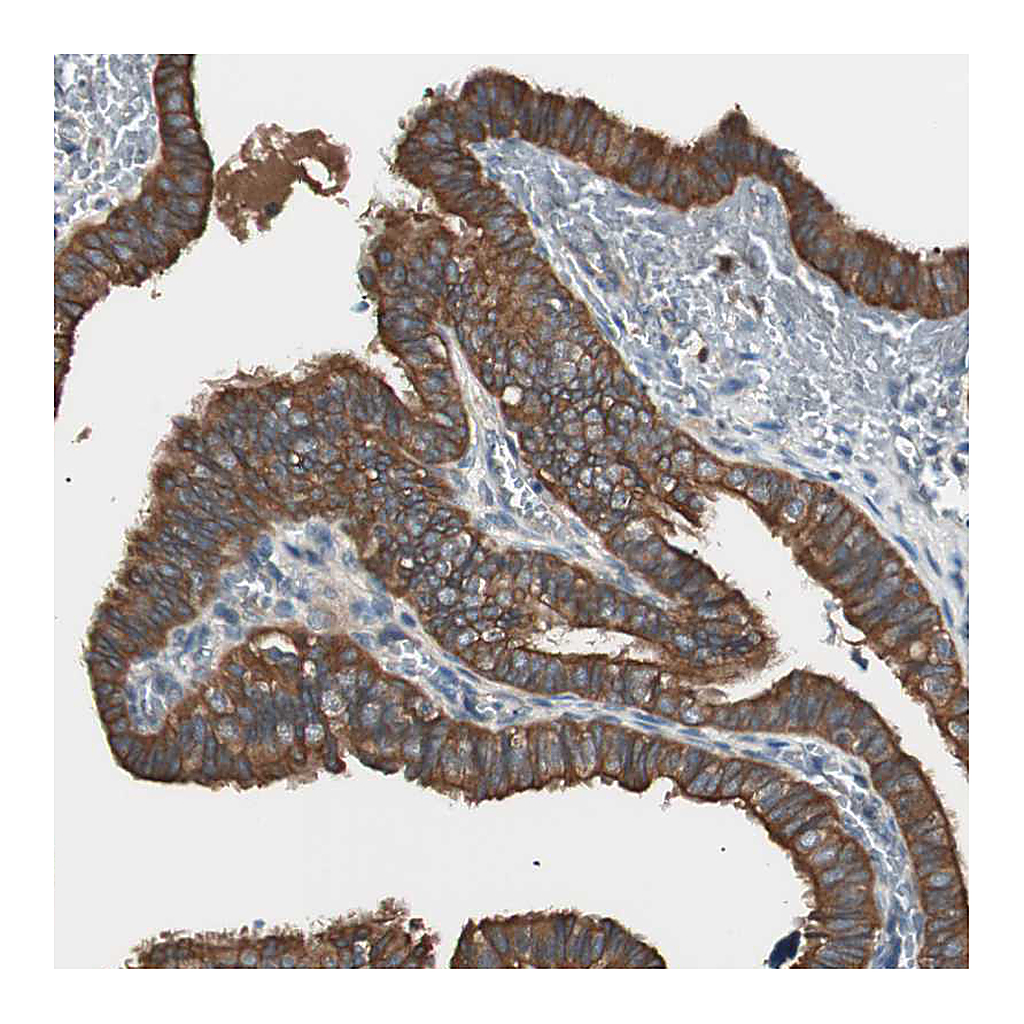 Atlas Antibodies Anti-TSG101 Antibody