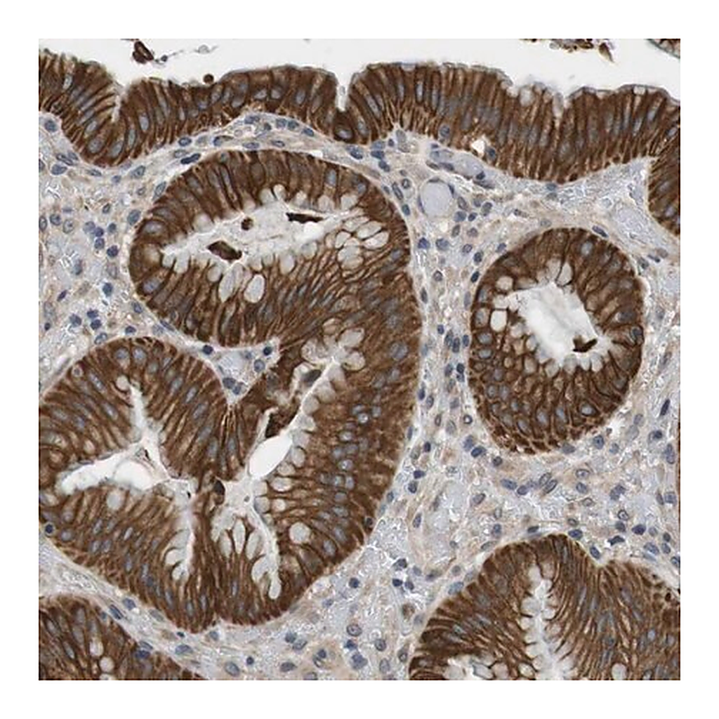 Merck Anti-ADGRL3 antibody produced in rabbit