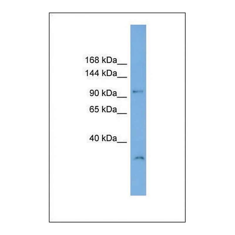 Merck Anti-DENND1A antibody produced in rabbit