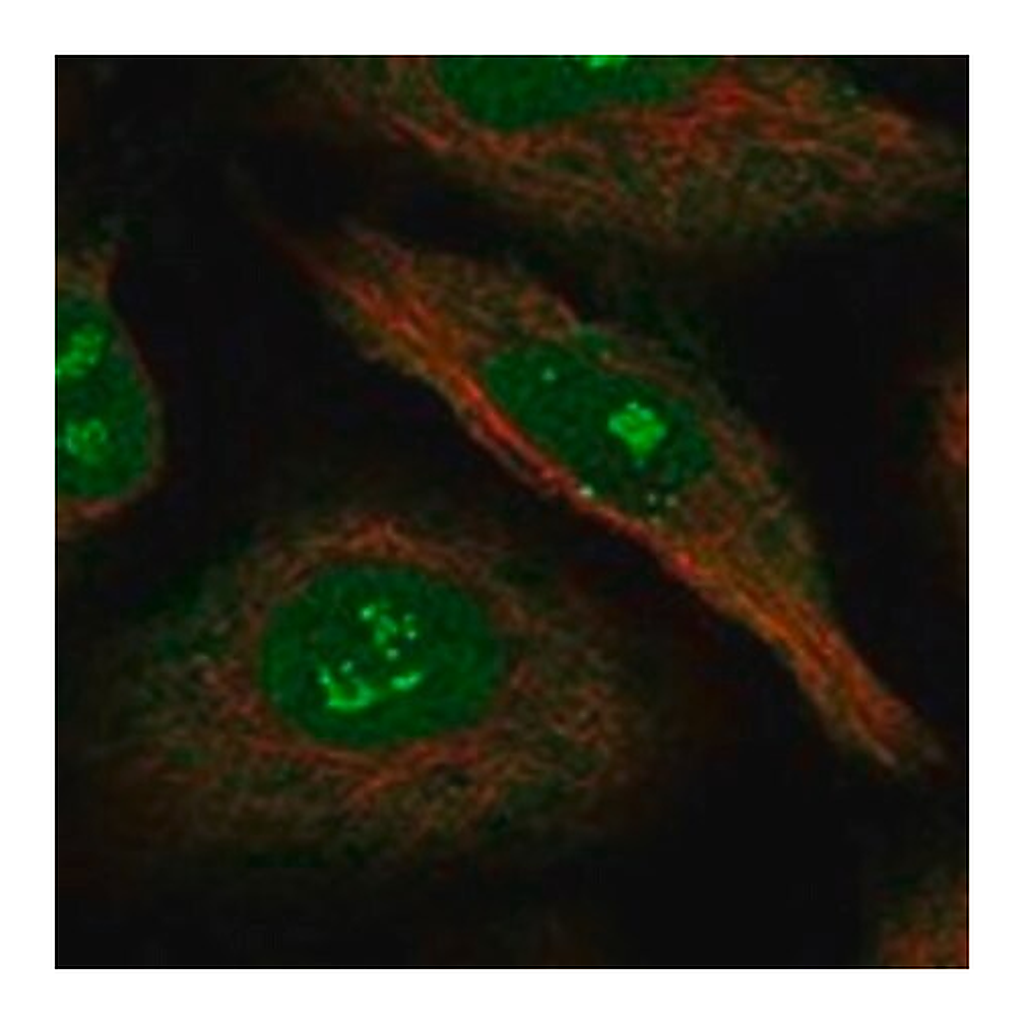 Merck Anti-NRIP1 antibody produced in rabbit