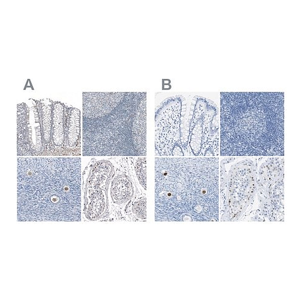 Merck Anti-SALL4 antibody produced in rabbit