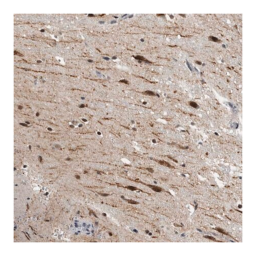 Merck Anti-ZMYND8 antibody produced in rabbit