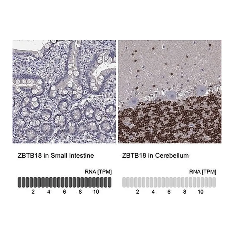 Merck Anti-ZBTB18 antibody produced in rabbit