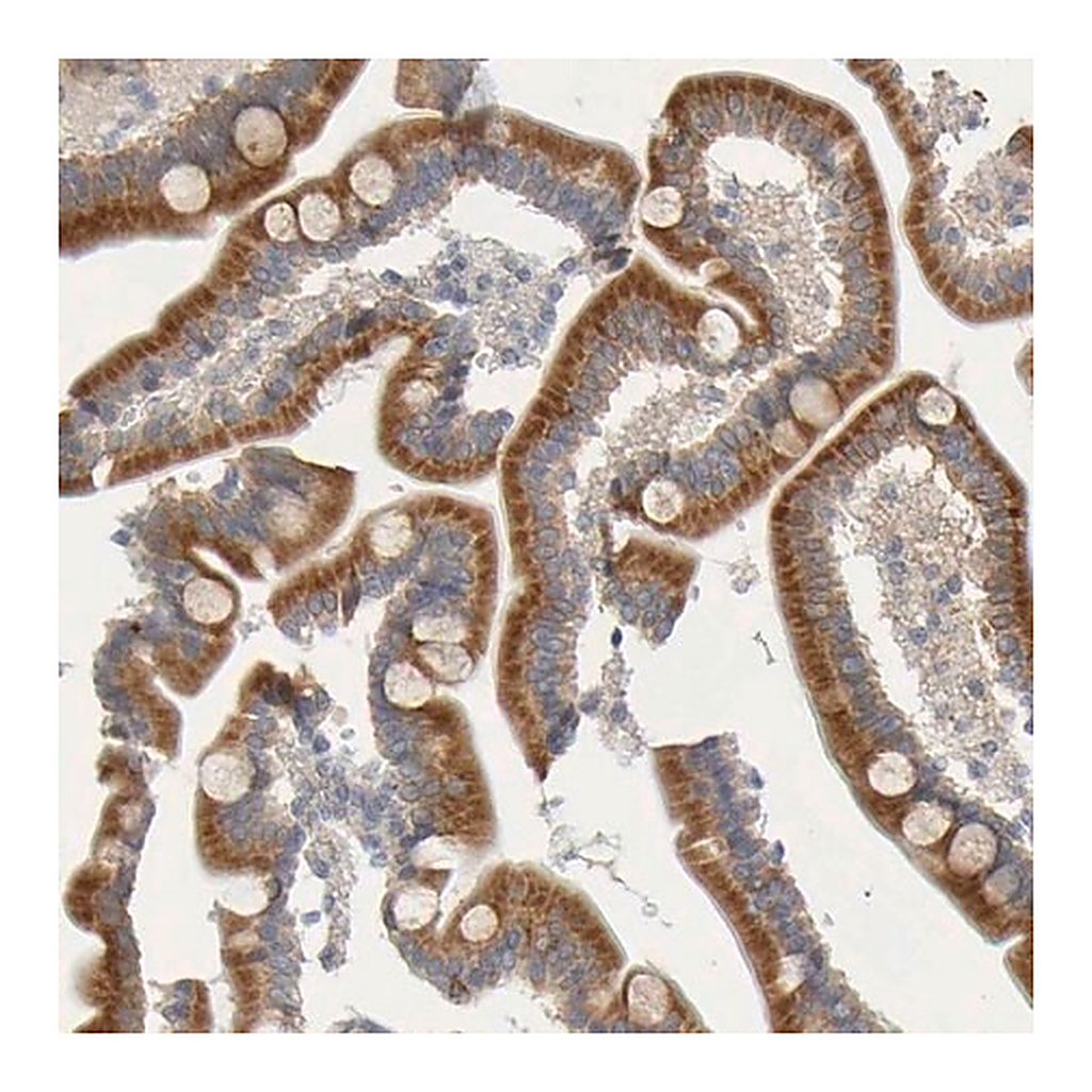 Merck Anti-MOGS antibody produced in rabbit