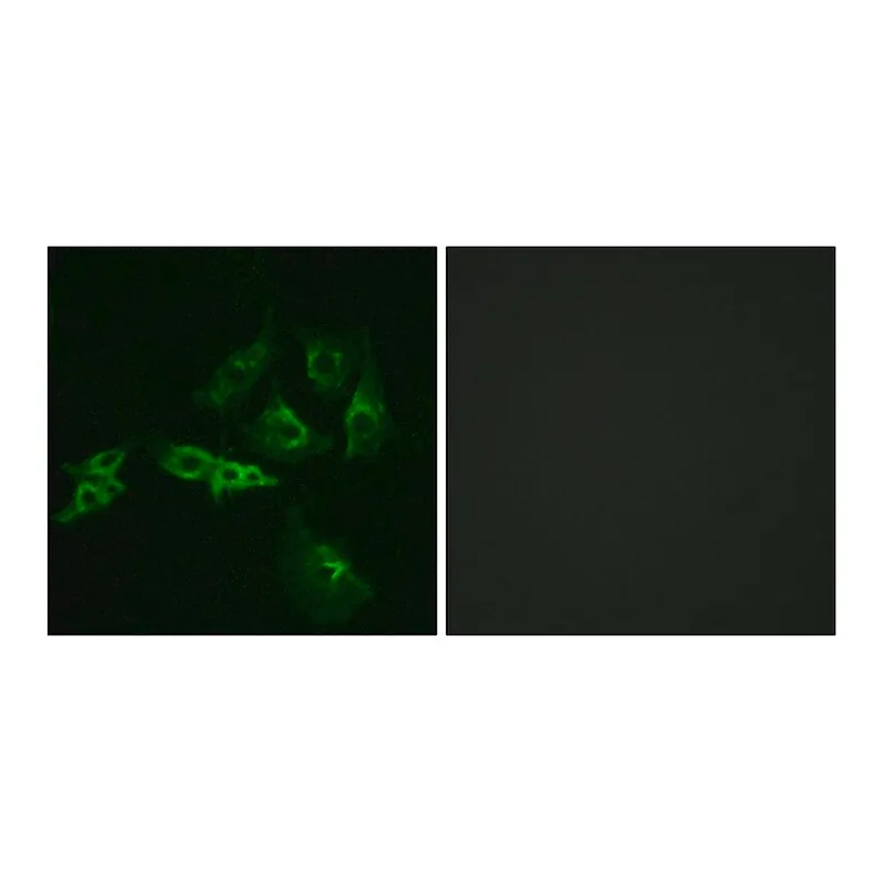 Merck Anti-GNRHR antibody produced in rabbit