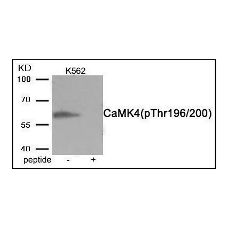 Merck Anti-phospho-CaMK4 (pThr196/200) antibody produced in rabbit